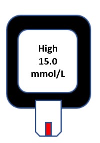 Hyperglycemia